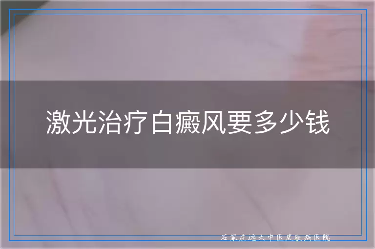 激光治疗白癜风要多少钱