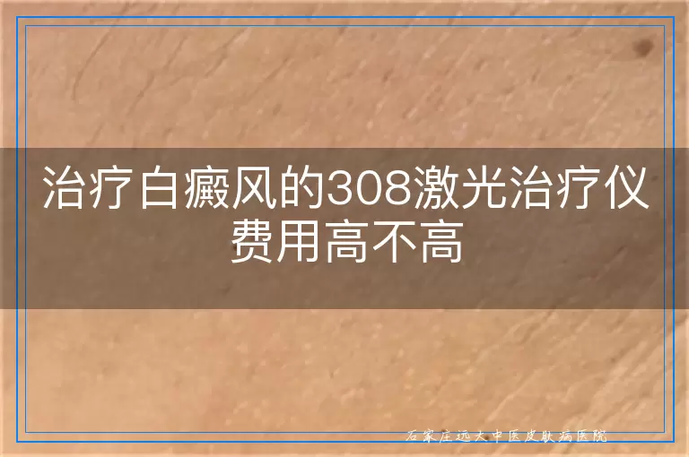 治疗白癜风的308激光治疗仪费用高不高