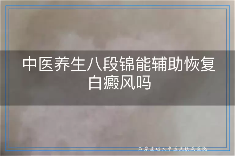 中医养生八段锦能辅助恢复白癜风吗