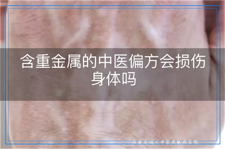 含重金属的中医偏方会损伤身体吗