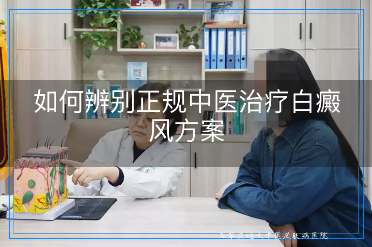 如何辨别正规中医治疗白癜风方案