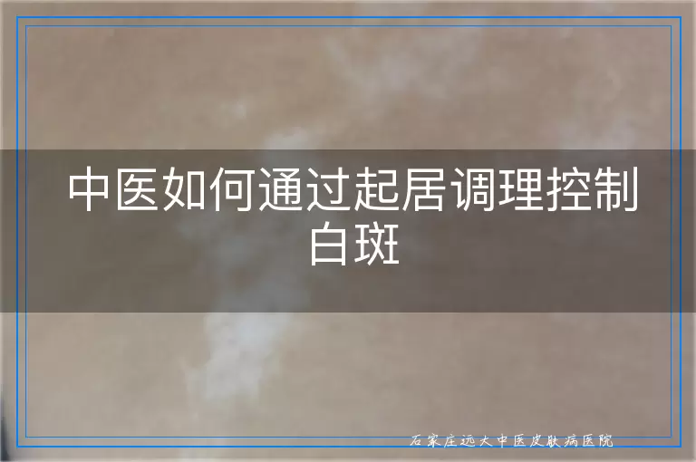 中医如何通过起居调理控制白斑