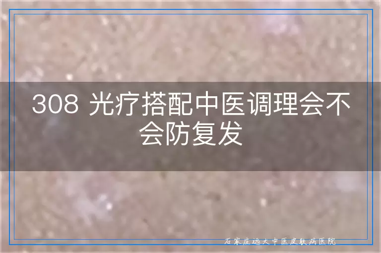 308 光疗搭配中医调理会不会防复发