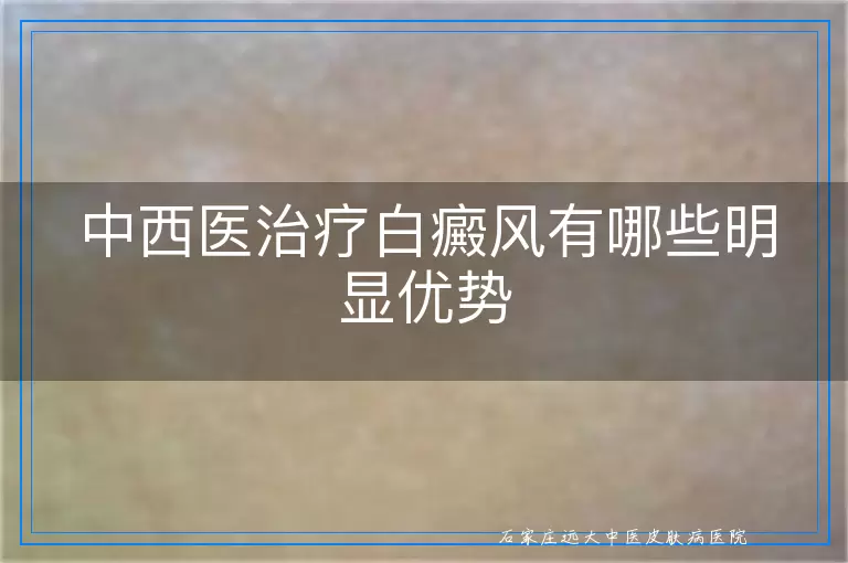 中西医治疗白癜风有哪些明显优势