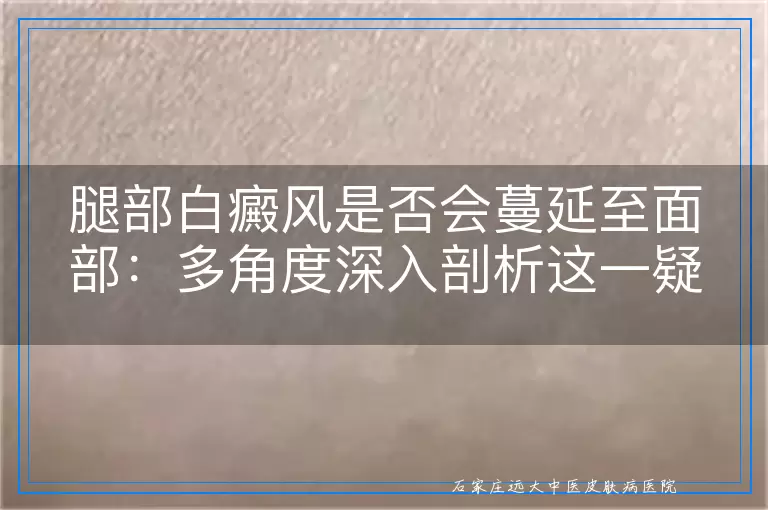 腿部白癜风是否会蔓延至面部：多角度深入剖析这一疑虑