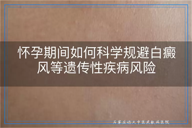 怀孕期间如何科学规避白癜风等遗传性疾病风险
