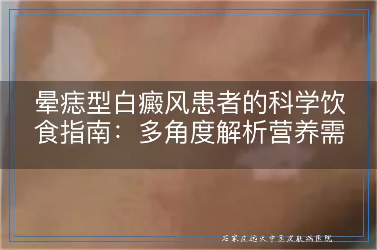 晕痣型白癜风患者的科学饮食指南：多角度解析营养需求与饮食禁忌