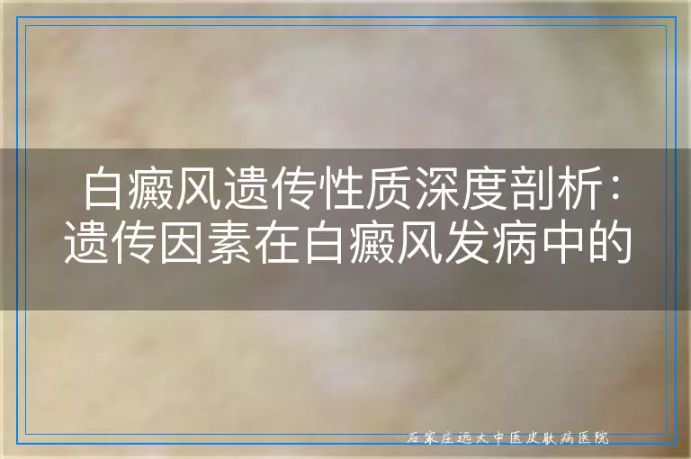 白癜风遗传性质深度剖析：遗传因素在白癜风发病中的角色