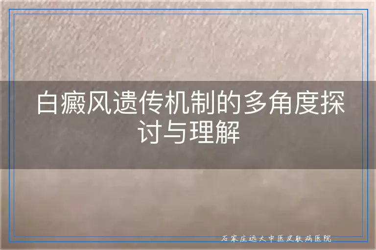 白癜风遗传机制的多角度探讨与理解