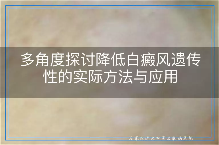 多角度探讨降低白癜风遗传性的实际方法与应用