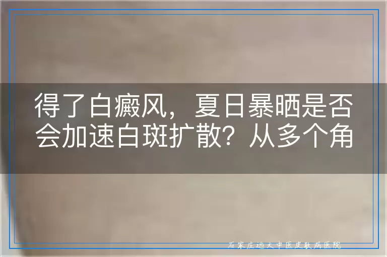 得了白癜风，夏日暴晒是否会加速白斑扩散？从多个角度探讨阳光对白癜风的影响