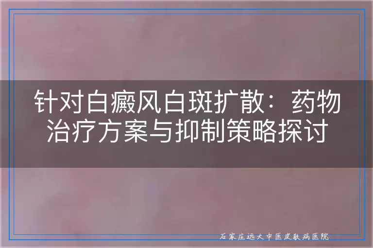 针对白癜风白斑扩散：药物治疗方案与抑制策略探讨