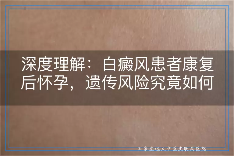 深度理解：白癜风患者康复后怀孕，遗传风险究竟如何？