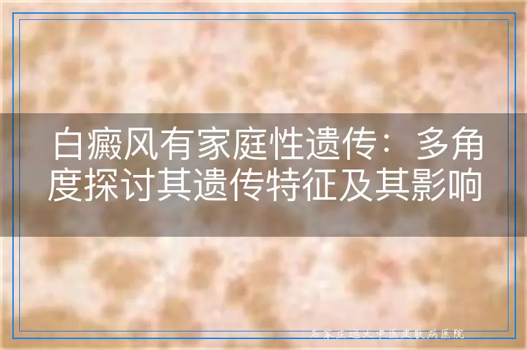 白癜风有家庭性遗传：多角度探讨其遗传特征及其影响
