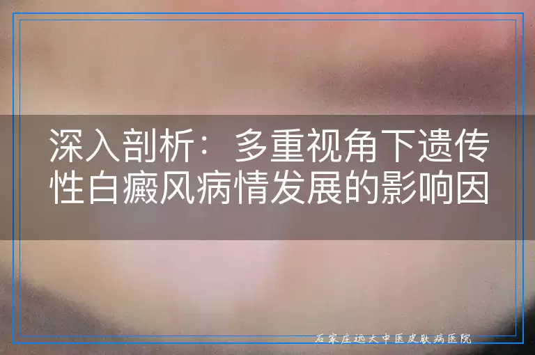 深入剖析：多重视角下遗传性白癜风病情发展的影响因素