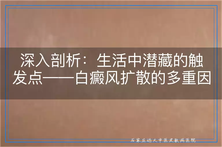 深入剖析：生活中潜藏的触发点——白癜风扩散的多重因素探讨