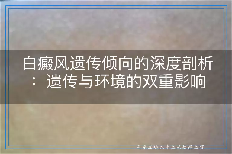 白癜风遗传倾向的深度剖析：遗传与环境的双重影响