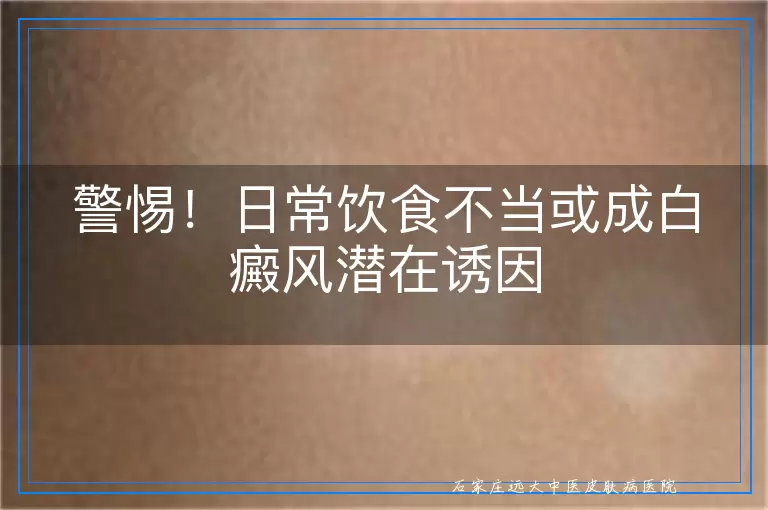 警惕！日常饮食不当或成白癜风潜在诱因