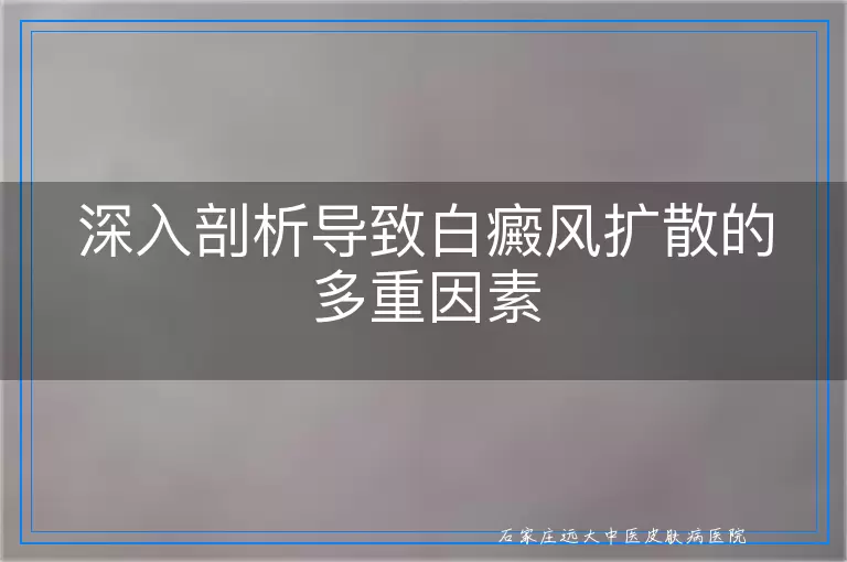 深入剖析导致白癜风扩散的多重因素