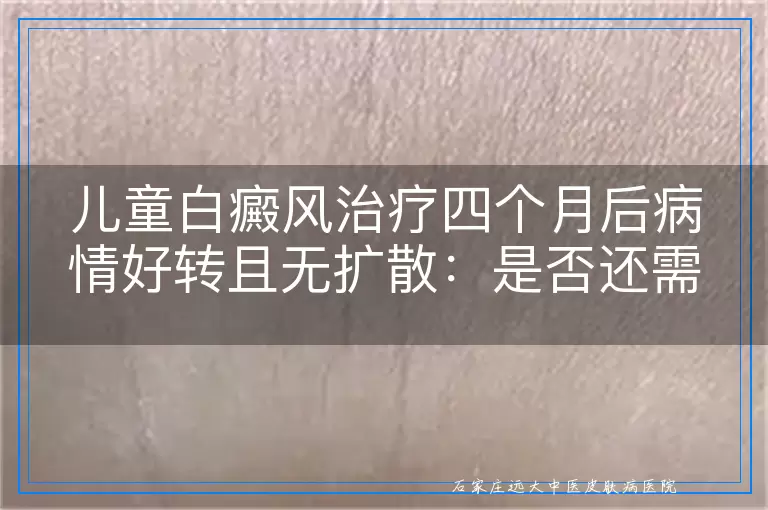 儿童白癜风治疗四个月后病情好转且无扩散：是否还需继续治疗？