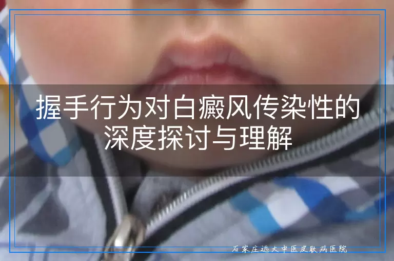 握手行为对白癜风传染性的深度探讨与理解