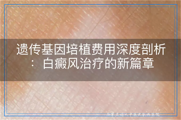 遗传基因培植费用深度剖析：白癜风治疗的新篇章