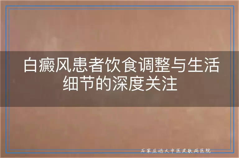 白癜风患者饮食调整与生活细节的深度关注