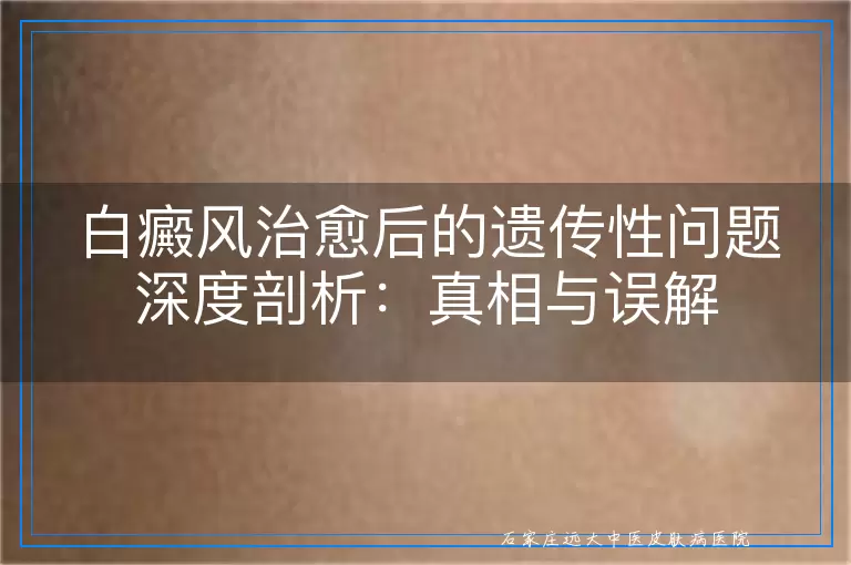 白癜风治愈后的遗传性问题深度剖析：真相与误解