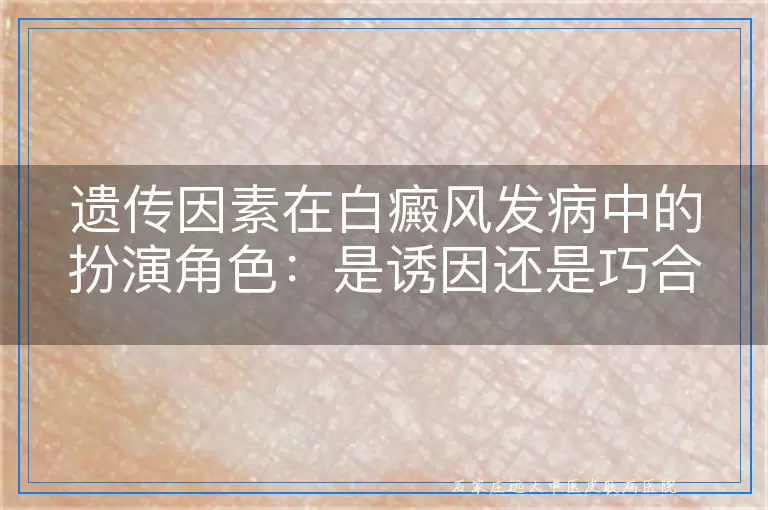 遗传因素在白癜风发病中的扮演角色：是诱因还是巧合？
