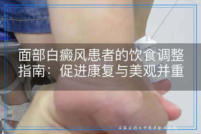 面部白癜风患者的饮食调整指南：促进康复与美观并重