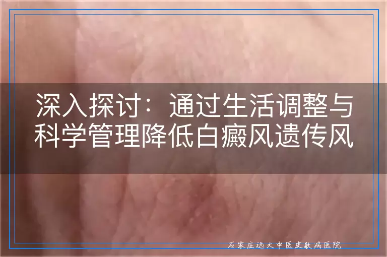 深入探讨：通过生活调整与科学管理降低白癜风遗传风险的途径