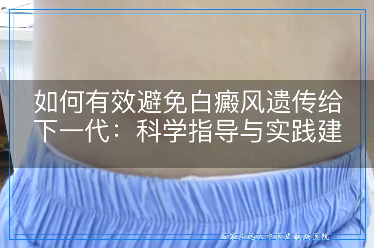 如何有效避免白癜风遗传给下一代：科学指导与实践建议