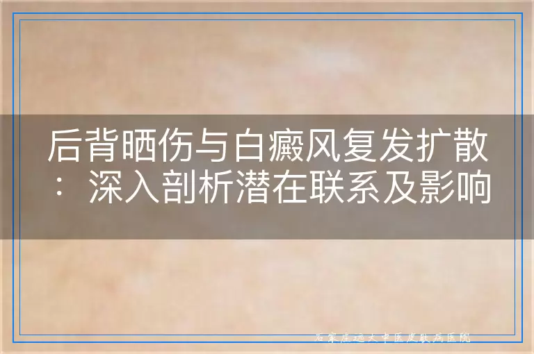 后背晒伤与白癜风复发扩散：深入剖析潜在联系及影响
