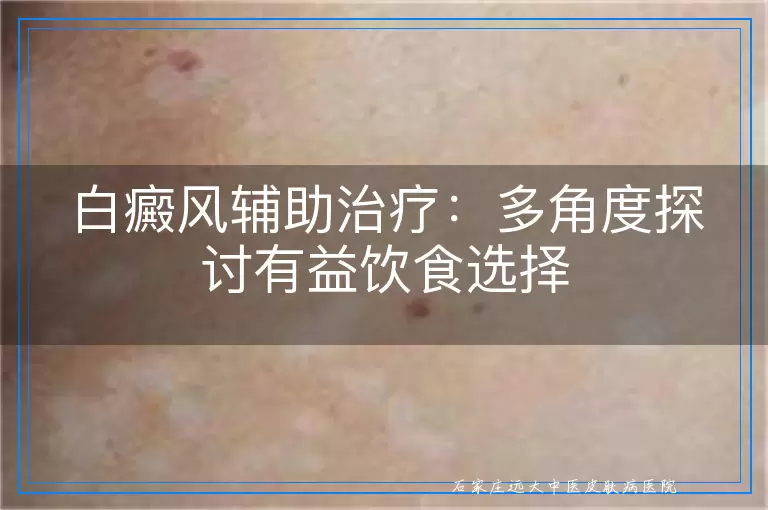 白癜风辅助治疗：多角度探讨有益饮食选择