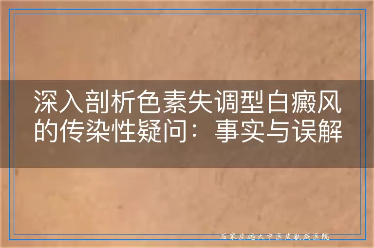 深入剖析色素失调型白癜风的传染性疑问：事实与误解