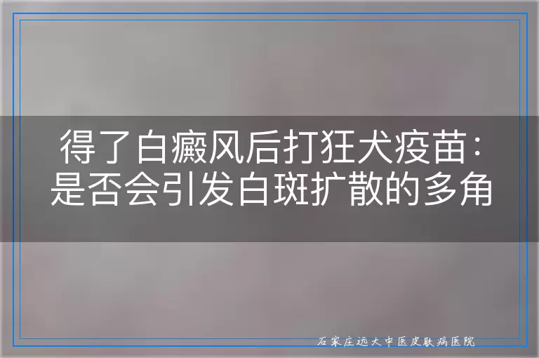 得了白癜风后打狂犬疫苗：是否会引发白斑扩散的多角度考量