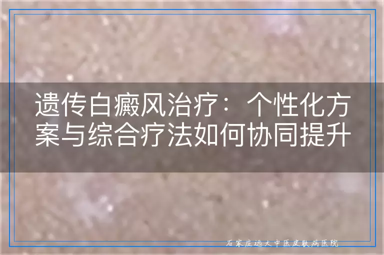 遗传白癜风治疗：个性化方案与综合疗法如何协同提升疗效