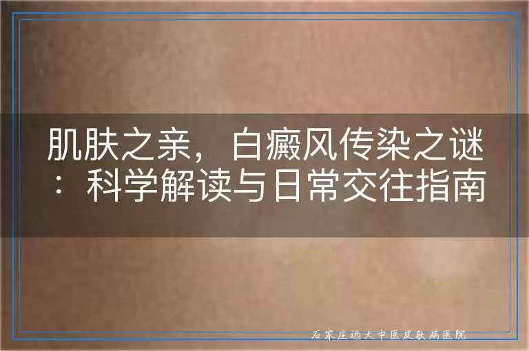 肌肤之亲，白癜风传染之谜：科学解读与日常交往指南
