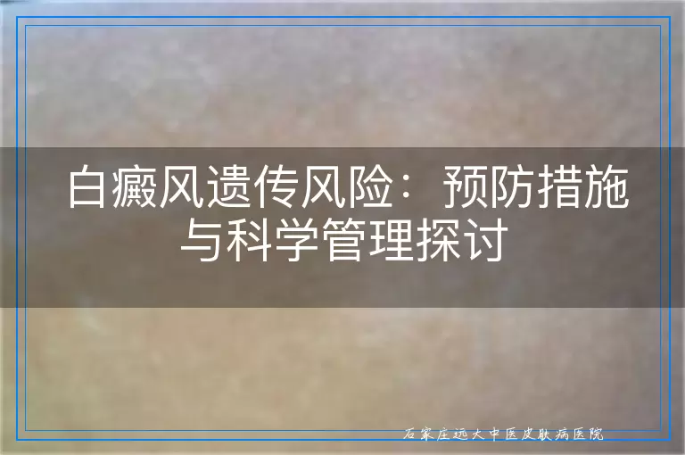 白癜风遗传风险：预防措施与科学管理探讨