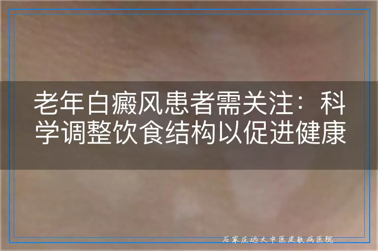 老年白癜风患者需关注：科学调整饮食结构以促进健康