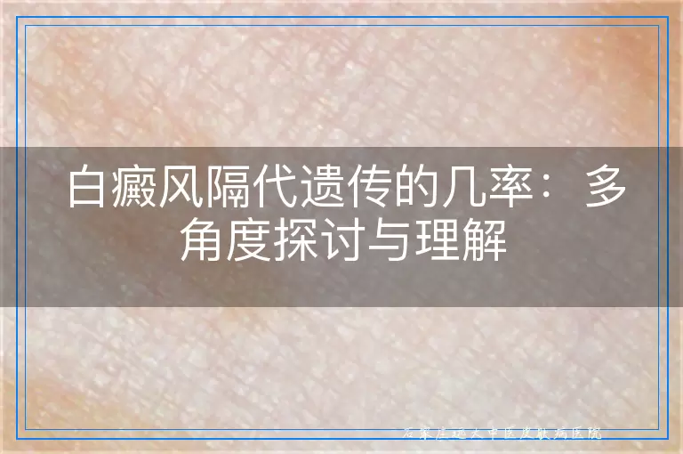 白癜风隔代遗传的几率：多角度探讨与理解