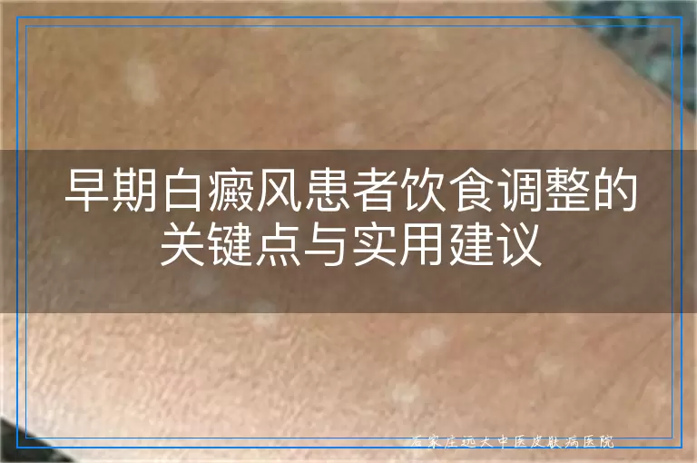 早期白癜风患者饮食调整的关键点与实用建议