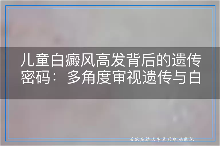 儿童白癜风高发背后的遗传密码：多角度审视遗传与白癜风的关系