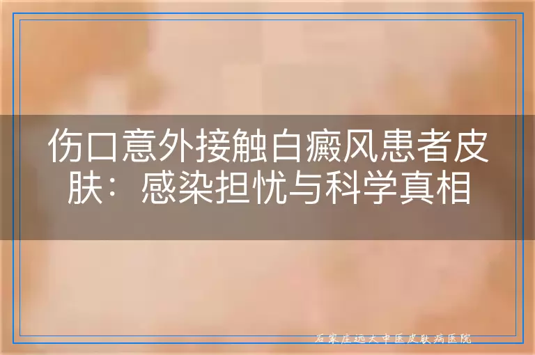 伤口意外接触白癜风患者皮肤：感染担忧与科学真相