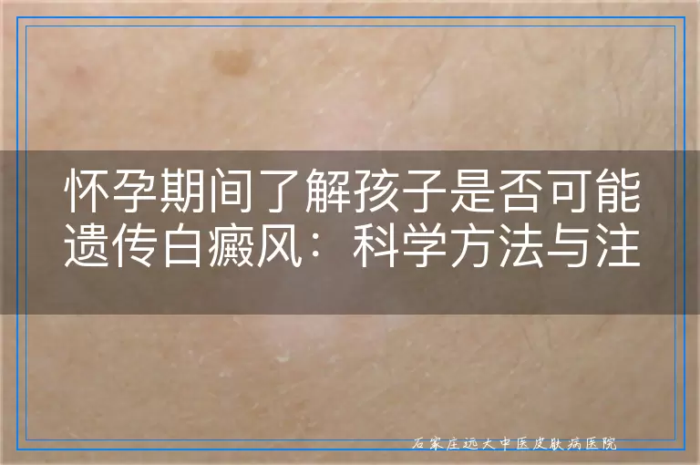 怀孕期间了解孩子是否可能遗传白癜风：科学方法与注意事项