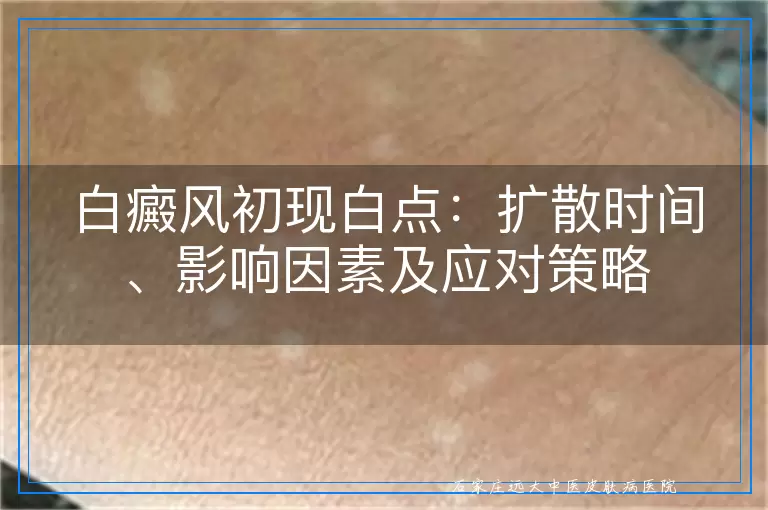 白癜风初现白点：扩散时间、影响因素及应对策略