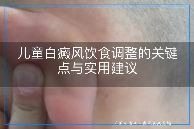 儿童白癜风饮食调整的关键点与实用建议