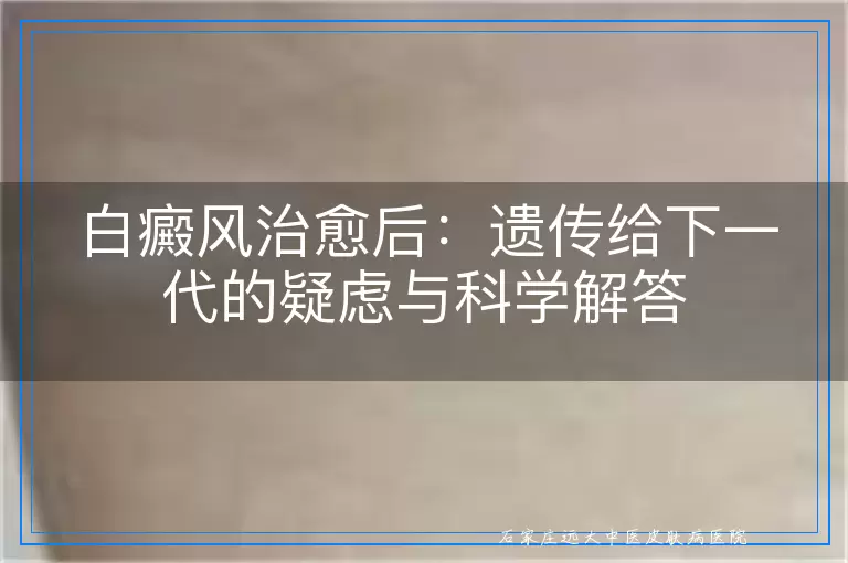 白癜风治愈后：遗传给下一代的疑虑与科学解答