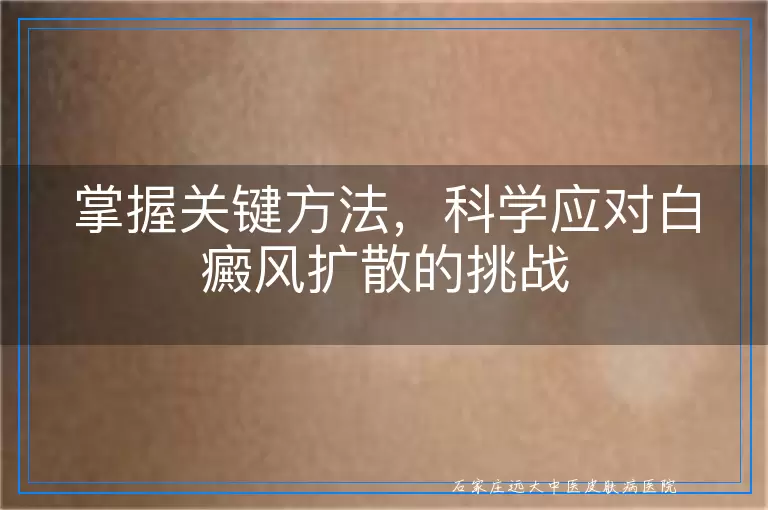 掌握关键方法，科学应对白癜风扩散的挑战