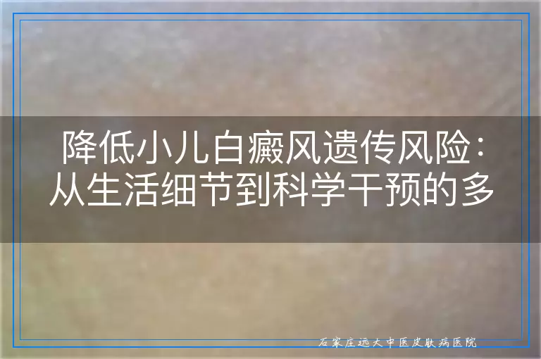 降低小儿白癜风遗传风险：从生活细节到科学干预的多维度指南